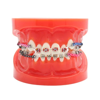 Dantų Modelio Dantų Modelio Skliausteliuose & Burnos Vamzdžiai Engle Corret Dantų Modelio Elastolink Grandinės Dantų Ortodontija Raudona