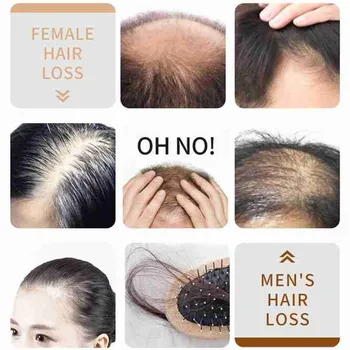 Imbieras Aliejaus Esmė Anti Hair Loss Shampoo Plaukų Augimą Augalų Esmė Gelis Plaukų Slinkimas Gydymo Galvos Odą Nuo Pleiskanų Kontrolės Aliejus Plaukų Priežiūra